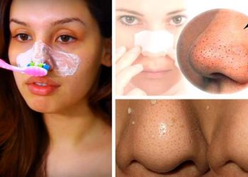 Blackhead Mask